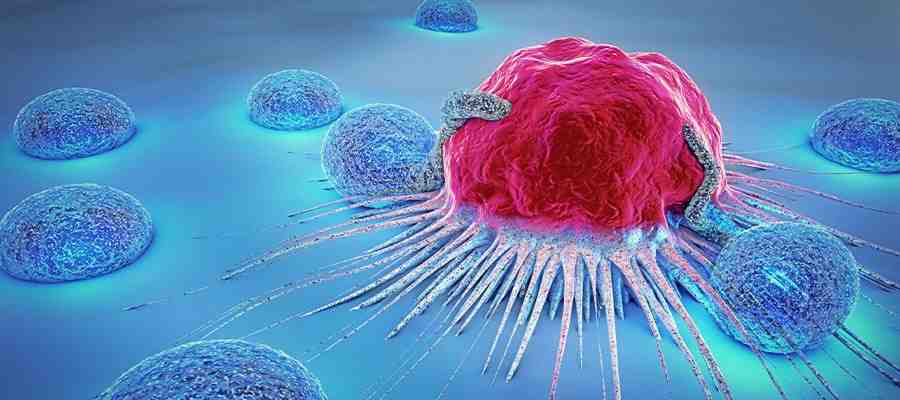 Best Cancer Doctor in Jaipur
